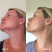 Очиститель для Кожи Clinisoothe+ Skin Purifier 250 мл